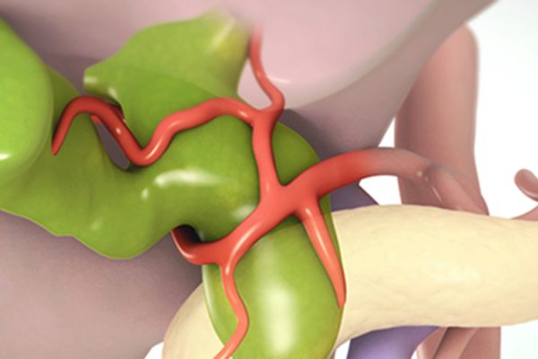 HEPATICOJEJUNOSTOMY