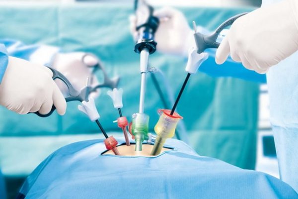 Laparoscopic Common bile duct Exploration