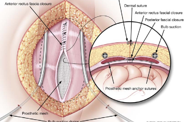 Rives – STOPPA Repair